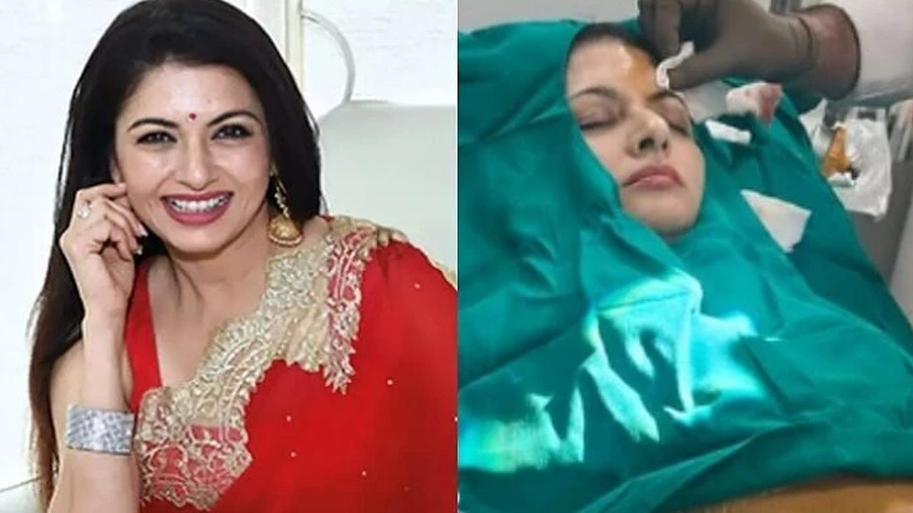 Actress Bhagyashree Injured: 13 Stitches on Forehead While Playing Pickleball Actress Bhagyashree Injured: 13 Stitches on Forehead While Playing Pickleball