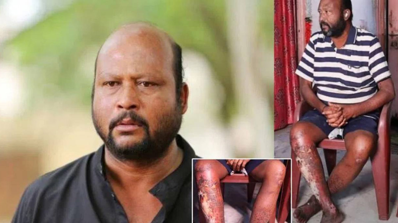 Pawan Kalyan Provides ₹2 Lakh Financial Aid to Actor Fish Venkat Amid Struggles, Emotional Video Goes Viral Pawan Kalyan Provides ₹2 Lakh Financial Aid to Actor Fish Venkat Amid Struggles, Emotional Video Goes Viral