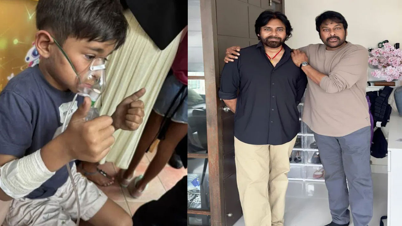 Pawan Kalyan's Son Mark Shankar Receives Special Treatment After Fire Accident in Singapore