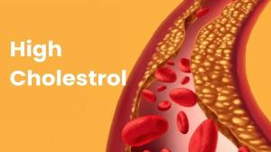 Signs of High Cholesterol